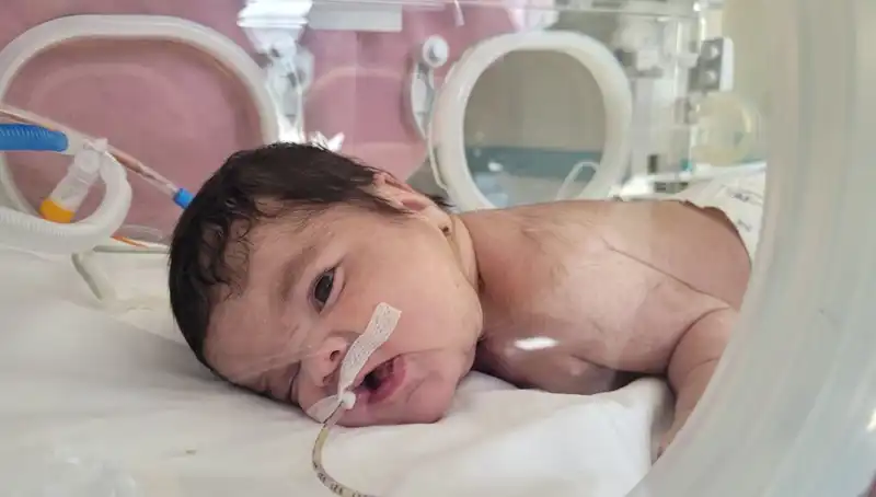 34 Haftalık Eymen Bebek, Tıpta Yeni Bir Dönem Mi Başlatıyor?