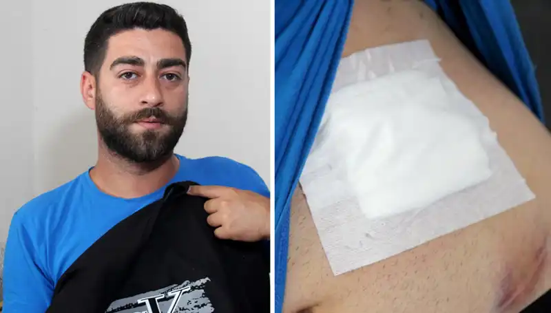 Karnındaki Ağrı: Gerçek Röntgende Şok Edici Sonuçlar Ortaya Çıktı