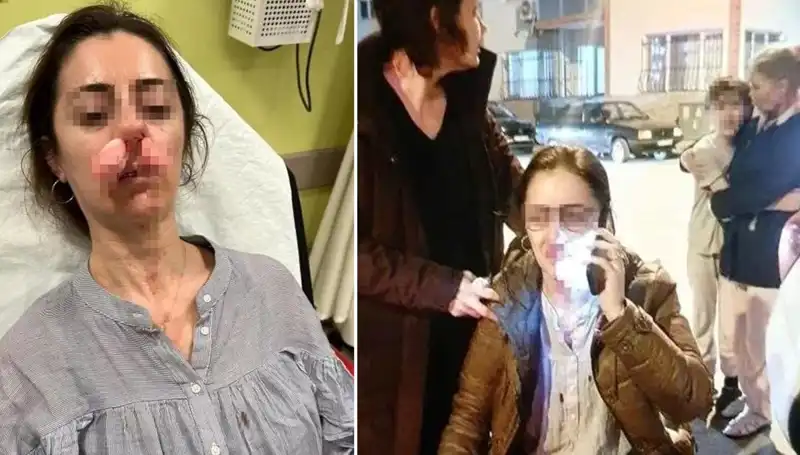 Otomobil Kapısı Saldırı Aracı Oldu: Kadın Kocası İçin Korkunç Olay!