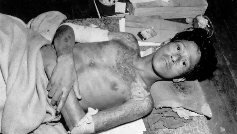 80 Yıl Sonra Nagasaki'den Haykırış: Nükleer Tehdit Yeniden Gündemde
