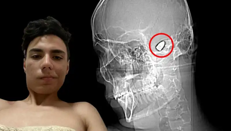 Kafasında Patlayıcı Düşünce: Modern Zihinlerin Bomba Gibi Sıkışması